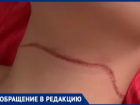 «Ловушка на детей»: 12-летний мальчик налетел горлом на натянутую леску во дворе Волгограда