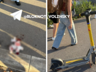 Рот не открывается полностью: о самочувствии сбитой электросамокатом женщины в Волжском