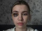 Волжане просят наказания для молодого человека, избившего девушку за отказ от прикосновений