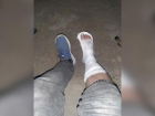 О сломанной ноге волжанина из-за ремонта дорог высказались в КБиДХ Волжского