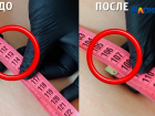 Лазерный липолиз или как убрать за раз несколько сантиметров в талии