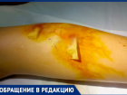 «Бросили ребенка, не оказав помощи»: волжанка ищет свидетелей нападения собаки на ее сына