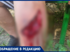 «Радуга смерти»: ребенок разорвал ногу до кости на детской площадке в Волжском