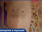 Свора чиповых собак напала на медсестру на территории больницы в Волжском  