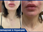 В Волжском у жительницы начался отек Квинке из-за вечерних выбросов и вони