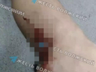 Собака напала на велокурьера в Волжском (18+)
