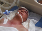 Раздроблен череп: врачи борются за жизнь 47-летнего отца двух детей в Волжском