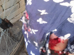 Огромный пес без намордника порвал ногу жительнице поселка под Волжским