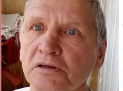 В Волжском ищут мужчину со шрамом на голове