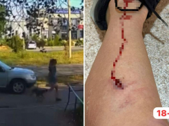 Уличная собака прокусила ногу молодой матери в Волжском