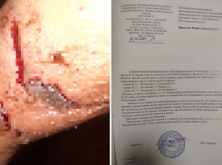 Более десятка пострадавших: в Волжском орудует агрессивная стая собак, нападающая на людей