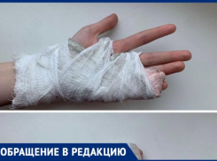 «Учителя не оказали никакой помощи»: в Волжском школьнице сломали палец на уроке