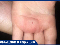 «Что творится на улице - ребенка покусал жук! » - волжанка