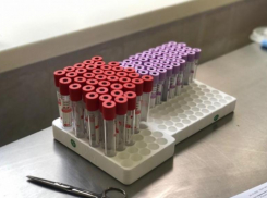 Больным COVID-19 в Волгоградской области перелили 610 литров антиковидной плазмы