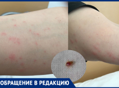 Клопы «атаковали» пациентов больницы им. Фишера в Волжском