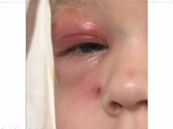 Разгневанный волжанин отправил жалобу на горе-врачей в Облздрав