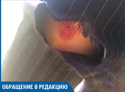 Я разодрала колено, упав в волгоградскую яму, - волжанка