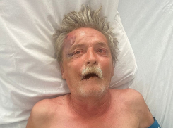 Попал в больницу с травмой головы: родственников мужчины с татуировкой «Скорпион» ищут в Волжском