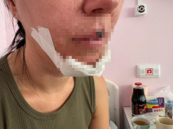 Просьба откликнуться девочек, оказавших помощь пострадавшей от самоката женщины в Волжском