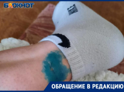 «Я плакала и кричала, а она грызла мне ногу»: в Волжском на студентку напала собака