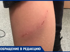 Агрессивные собаки истерзали школьника в Волжском