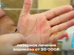 Лечение варикоза по низким ценам в Волжском! 