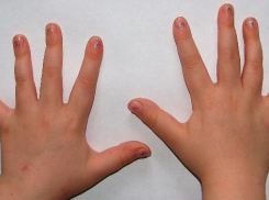 В Волжском молодая безработная мать отбила дочери руки 