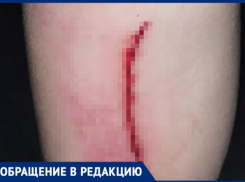 Ребенок распорол ногу на детской площадке в Волжском