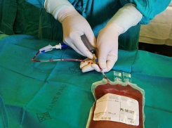 Волжанке с лейкозом провели трансплантацию костного мозга в Турции