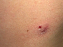 Бездомная собака напала на девушку в Волжском