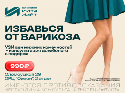 Этим летом - полная диагностика варикоза за 990 ₽ в «Вита-Лайт»