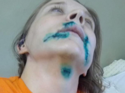 Родилась в рубашке: женщина-водитель такси приходит в себя после ножевых ранений в праздники