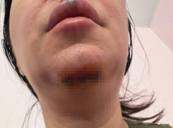 В Волжском возбуждено первое уголовное дело с электросамокатом: личность девочки установлена