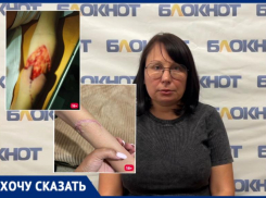 «Моему сыну вырвали клок руки»: ребенок получил увечье на всю жизнь в школе Волжского
