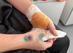 Жизнь разделилась на «до» и «после»: последствия трагедии с самокатом в Волжском