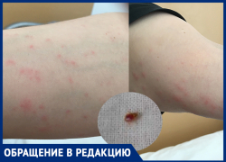 Клопы «атаковали» пациентов больницы им. Фишера в Волжском
