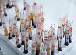 Результаты анализа на COVID-19 жители области получат быстрее