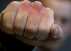 Супружескую пару избили и обокрали в Волжском