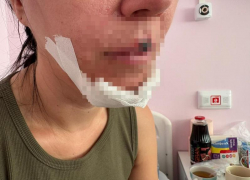 Просьба откликнуться девочек, оказавших помощь пострадавшей от самоката женщины в Волжском