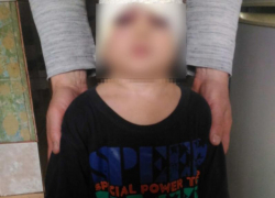 В Волжском пьяный отчим избил трехлетнего малыша до гематом и травм головы