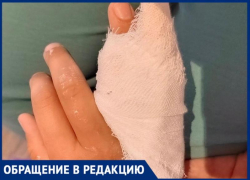 Ребенок сломал руку в летнем лагере на базе батутного городка в Волжском