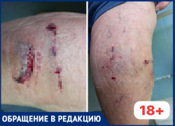 В Волжском прохожий безучастно наблюдал, как женщину грызли собаки