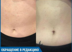 За час в Волжском я покрылась аллергией, - горожанка