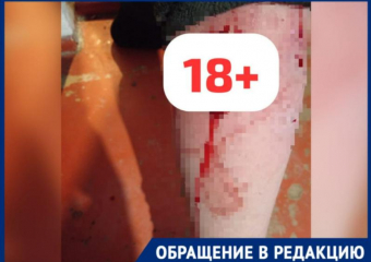 «Бродячие собаки  рвали клыками ногу моего сына»,- волжанка о страшном нападении