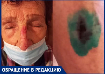 «Разбила лицо в кровь»: в Волжском пожилая женщина упала на месте ремонтных работ в ТЦ «Идея»