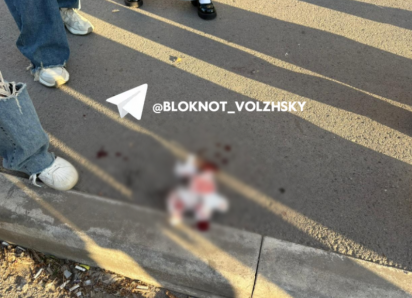 Пострадавшей от самоката предстоит сложная операция на челюсть в Волжском