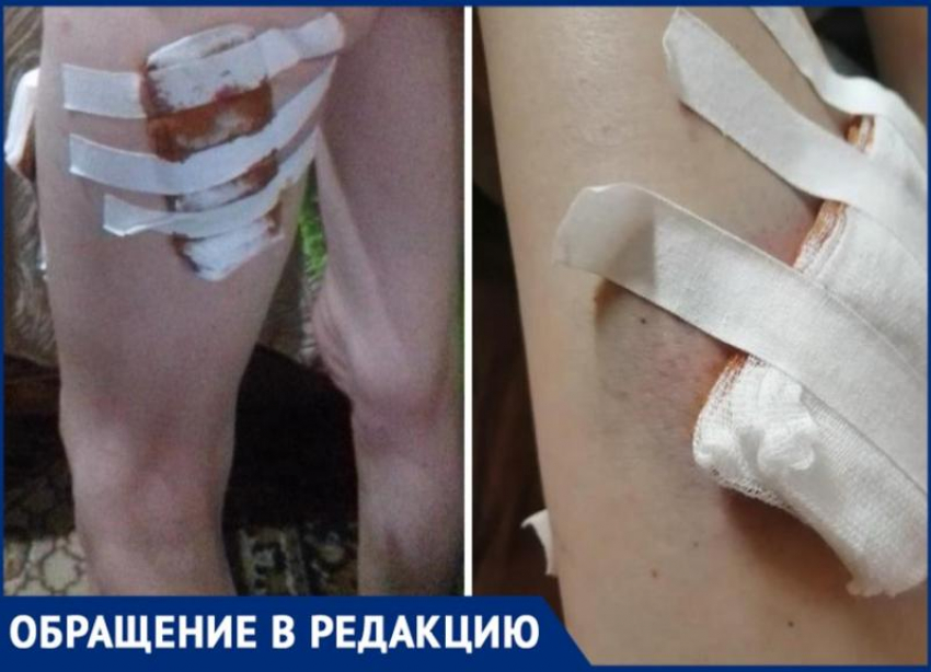 Свора бездомных собак растерзала девушку в сквере в Волжском