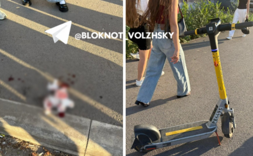 Рот не открывается полностью: о самочувствии сбитой электросамокатом женщины в Волжском