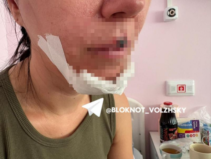 Дело о сбитой самокатом волжанке дошло до главы Следственного комитета России