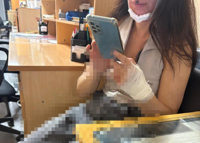 Наркоз с осложнениями и реабилитация: как чувствует себя сбитая электросамокатом женщина в Волжском